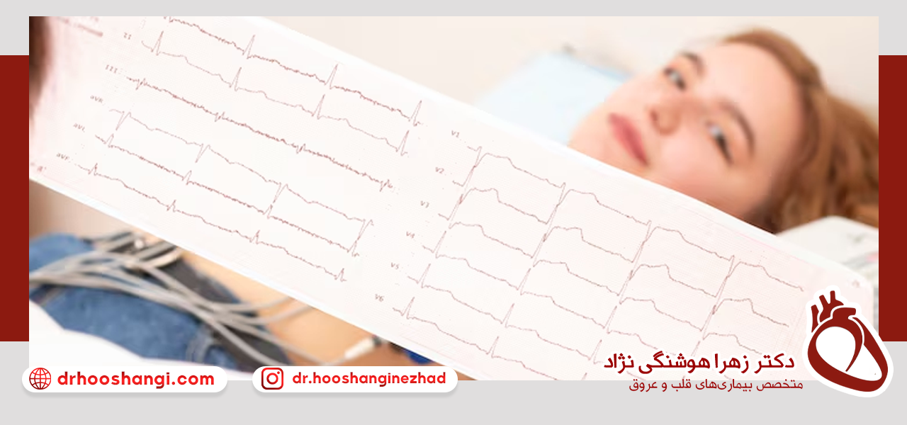 نوار قلب چگونه انجام میشود؟