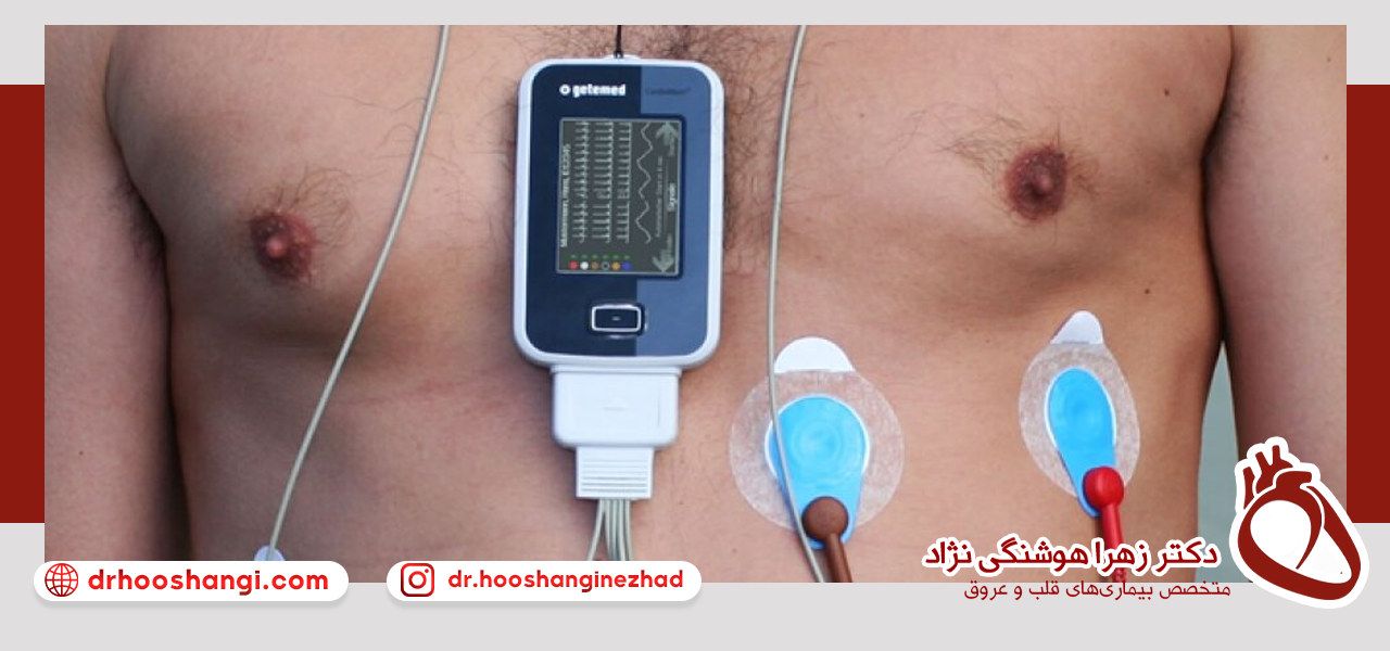نحوه کارکرد هولتر قلب چگونه است؟