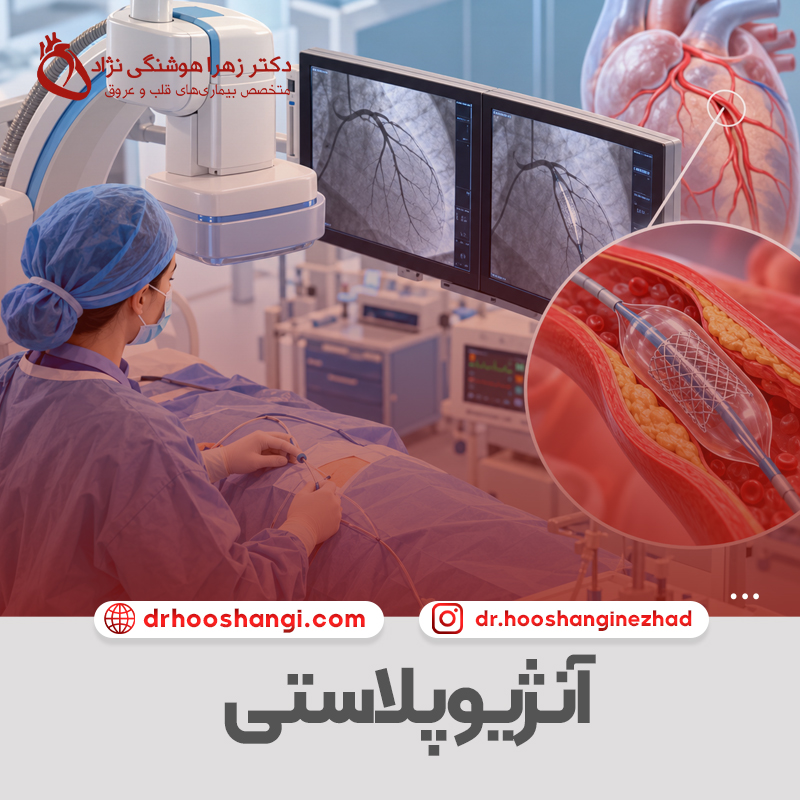 آنژیوپلاستی